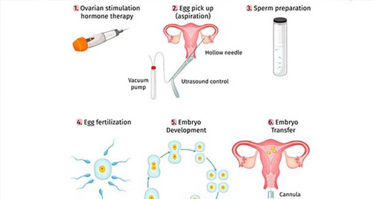 仅参考：怀孕有这些症状95%都会生男孩‼️ 试管供卵网
